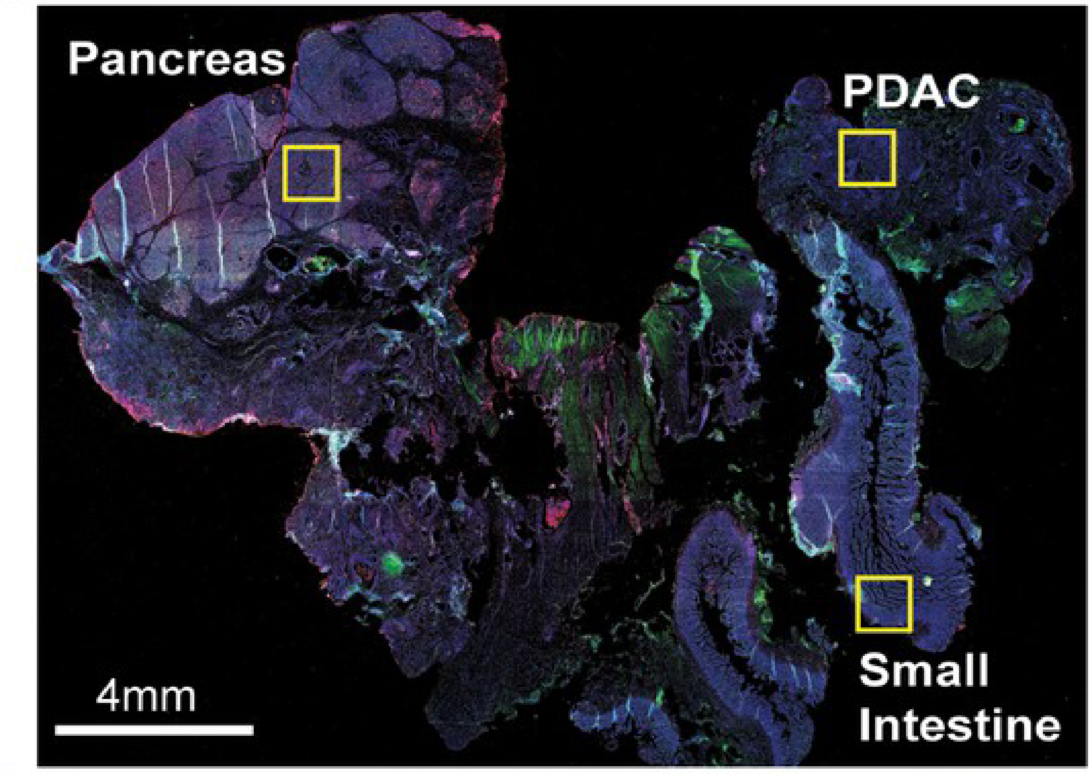 Identical sample as H&E stained image above, this section was stained with antibodies & imaged with fluorescent imaging (from Lin et al., 2018, eLife.)